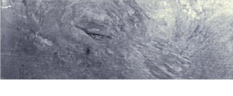 Defectos en la superficie de fundición de aluminio 2.png